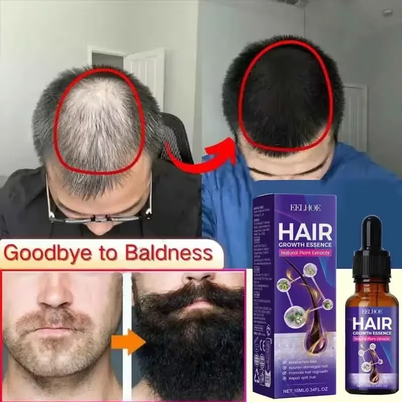 Hair Care Vitamin - Hair Growth Essential Loss Regrowth Treatment