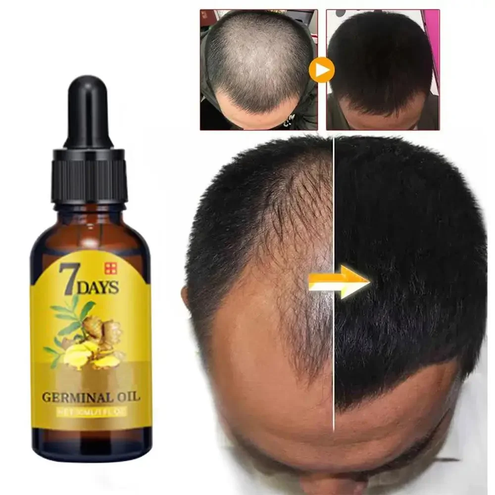 Hair Care Fragrance Essential Oil - Hair Growth Ginger Fast Growing Hair