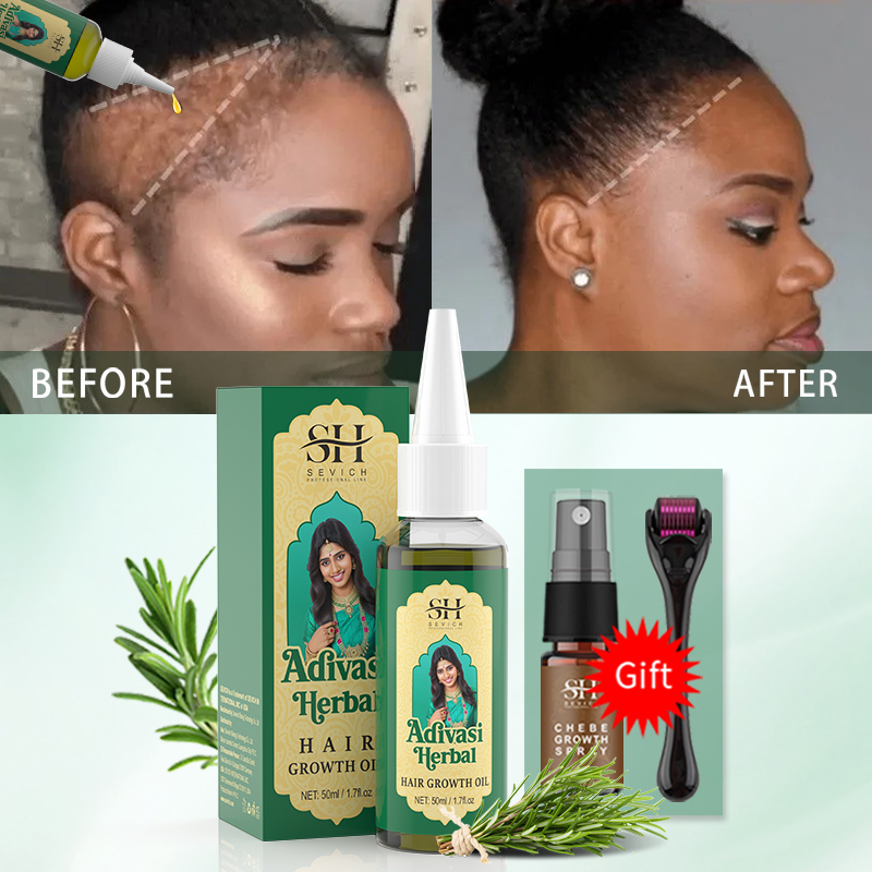 Ayurvedic Hair Growth Oil Indi - đánh giá và giá Hair Care Fragrance Essential Oil