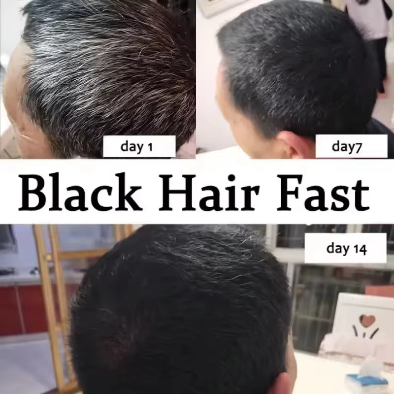 Gray White Hair Treatment Seru - đánh giá và giá Hair Care Ginseng