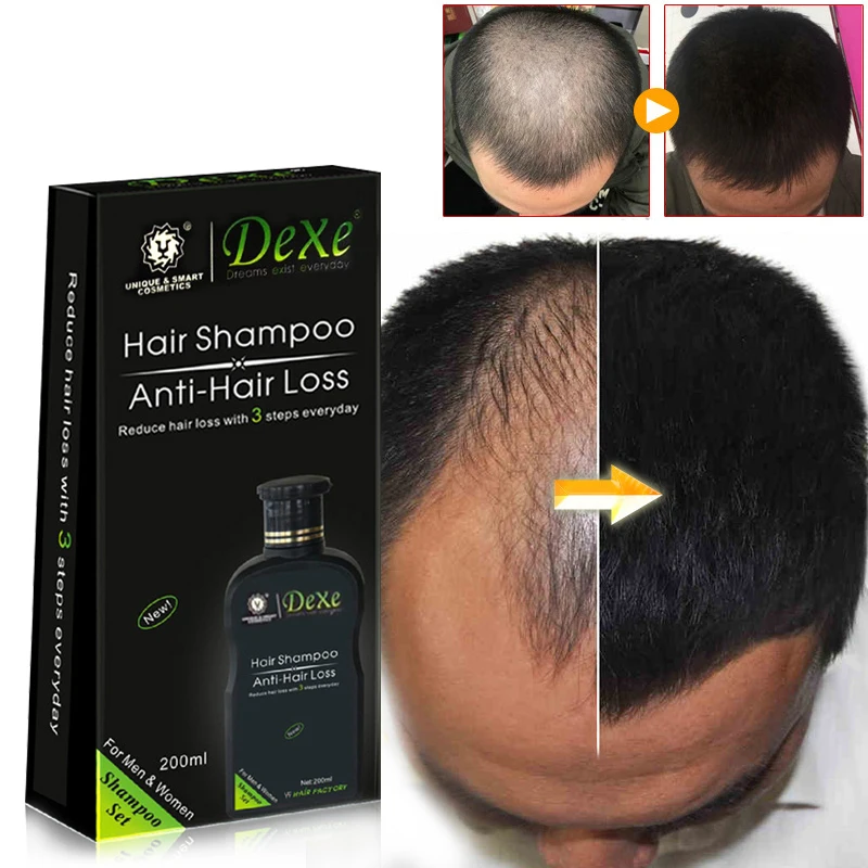 Professional hair growth Shamp - đánh giá và giá Hair Care Herbal