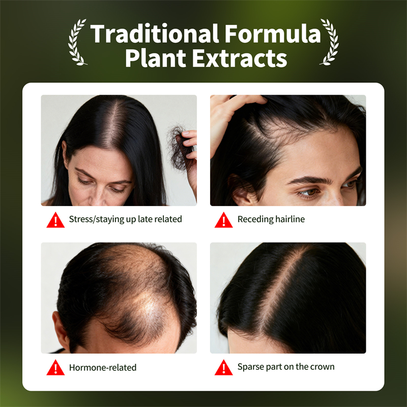 Natural Hair Growth Set Usman  - đánh giá và giá Hair Care Herbal