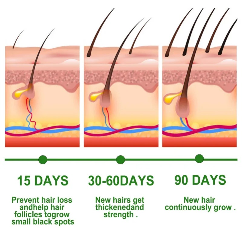 Hair Growth Serum Fast Growing - đánh giá và giá Hair Care Fragrance Essential Oil