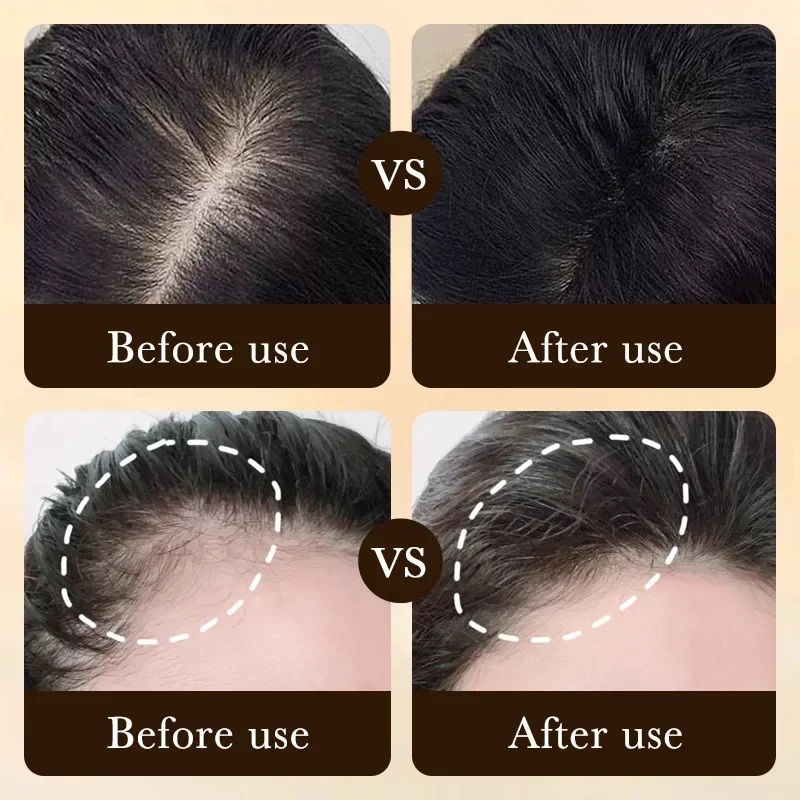 Biotin Fast Hair Growth Oil Pr - đánh giá và giá Hair Care Fragrance Essential Oil