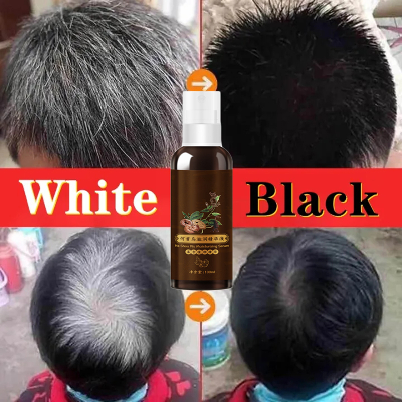 100ml Polygonum Multiflorum Na - đánh giá và giá Hair Care Herbal