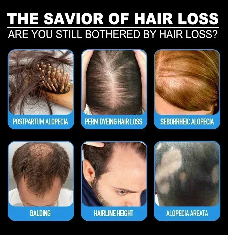 Hair Growth Essential Loss Reg - đánh giá và giá Hair Care Vitamin