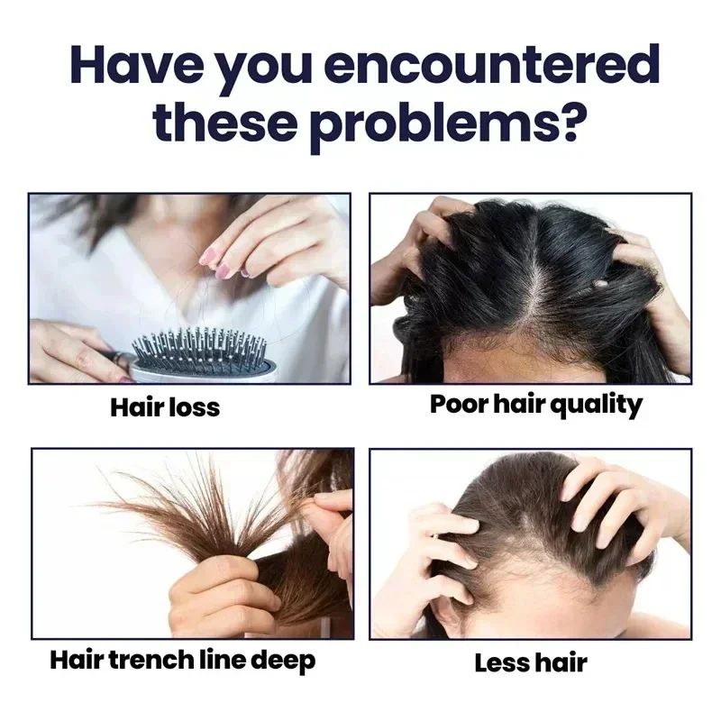 Hair Growth Essential Loss Reg - đánh giá và giá Hair Care Vitamin