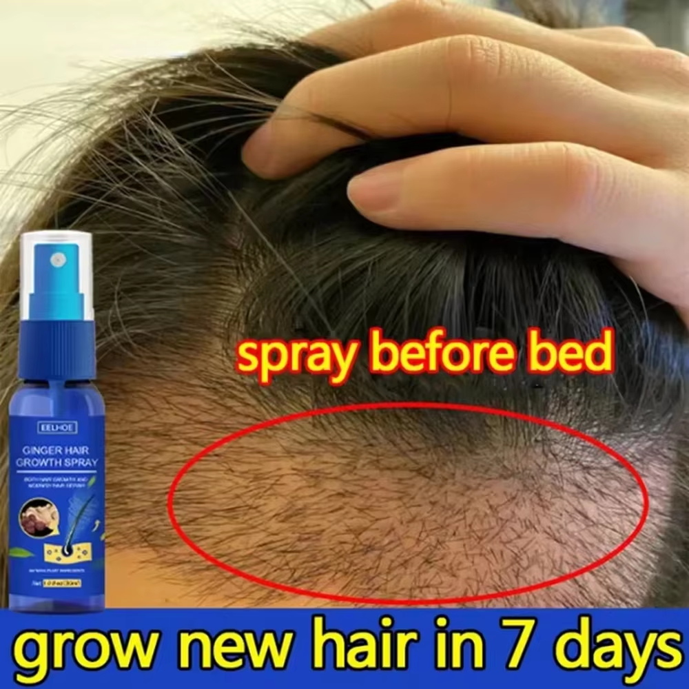 Fast Ginger Hair Growth Spray  - đánh giá và giá Hair Care For Men