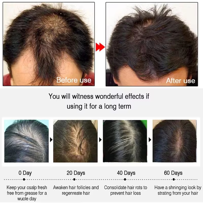 Fast Ginger Hair Growth Spray  - đánh giá và giá Hair Care For Men