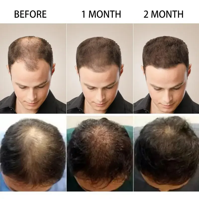 Hair Growth Ginger Fast Growin - đánh giá và giá Hair Care Fragrance Essential Oil
