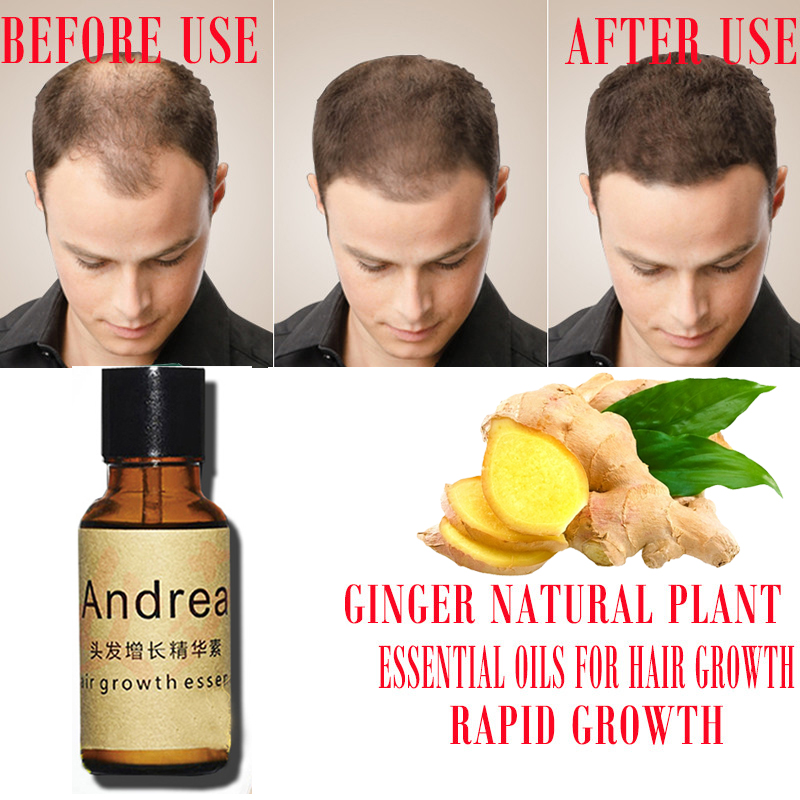 2/5/10Pcs Andrea Hair Growth S - đánh giá và giá Hair Care Herbal