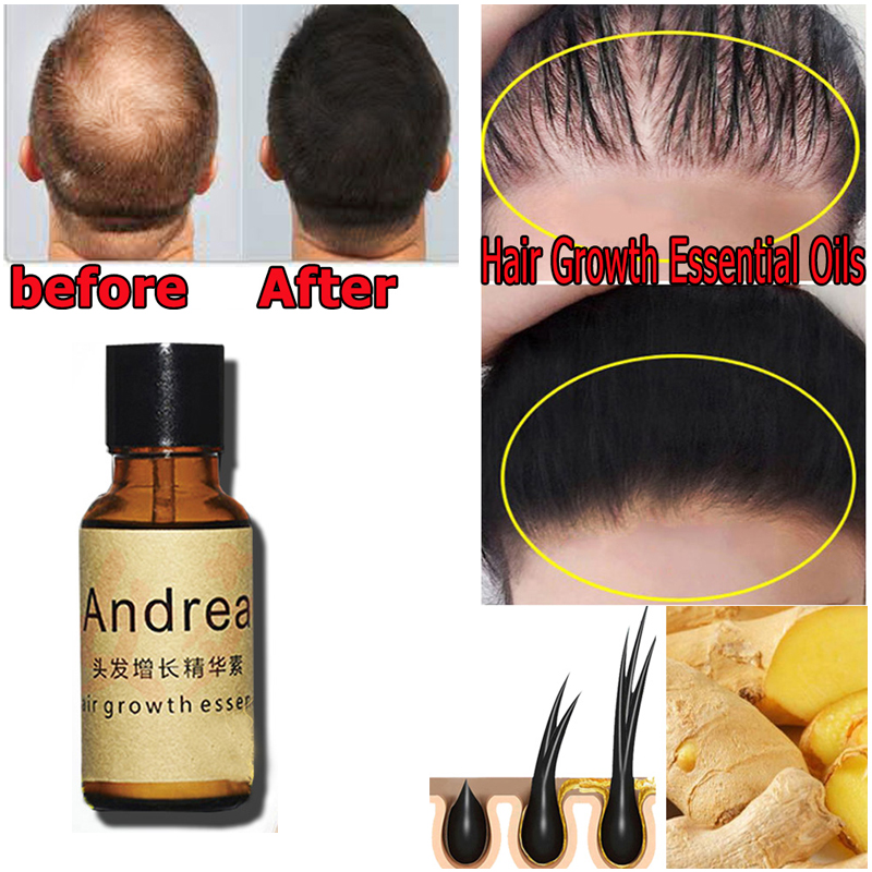 2/5/10Pcs Andrea Hair Growth S - đánh giá và giá Hair Care Herbal